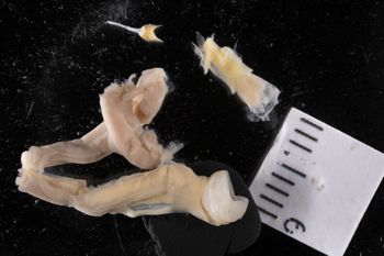 Media type: image;   Malacology 169661 Description: Digital documentation photo of preserved specimen;